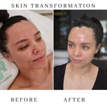 Load image into Gallery viewer, Refinery Anti-Ageing Facial